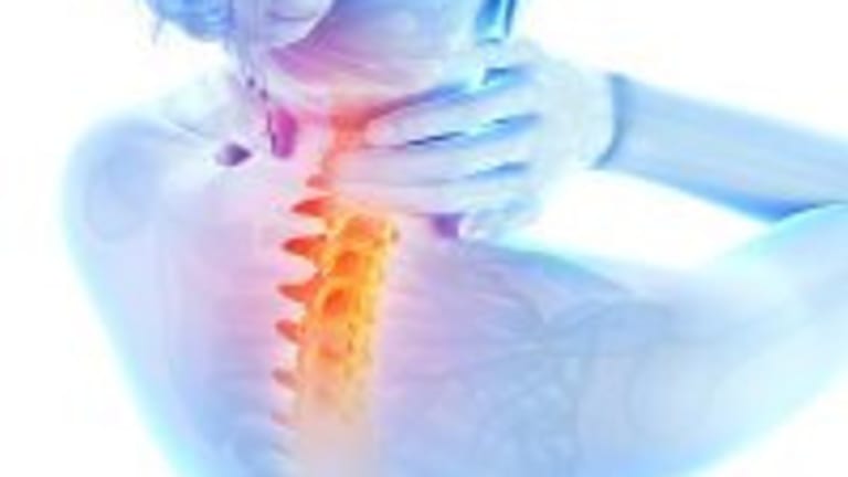 How to Relieve a Stiff Neck-Tips on a Common Condition and Self-care Measures