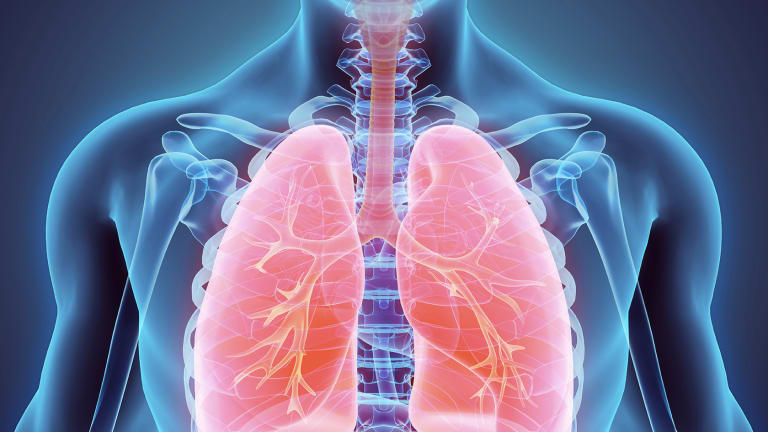 Rituxan Treatment Improves Rheumatoid Associated Interstitial Lung Disease