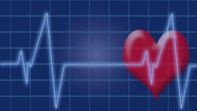 Inflammatory Arthritis & Heart Disease