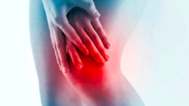 Precision Trial Suggests Celecoxib Safe for Arthritis
