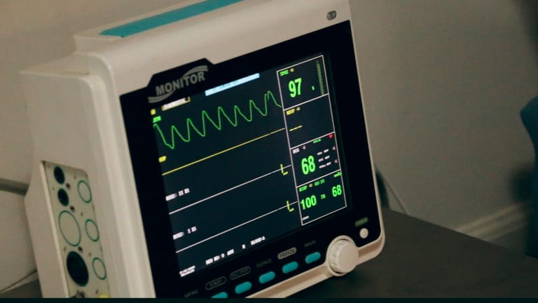 Acute Coronary Syndrome Increased in Early Rheumatoid Arthritis