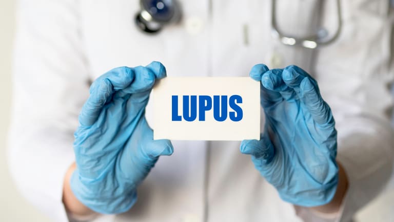 Systemic Lupus, Where to Begin