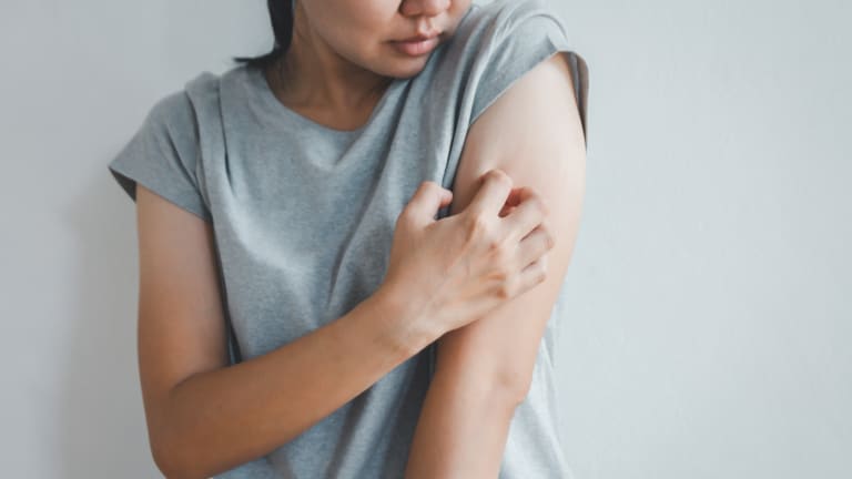 Solutions to Problem Itching