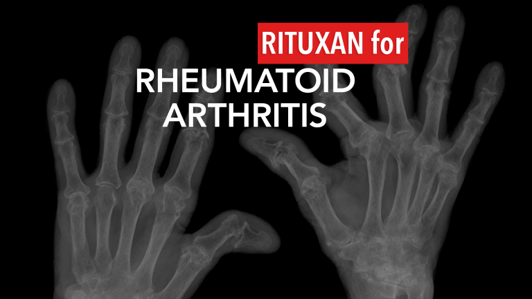 Rituxan Treatment in Rheumatoid Arthritis