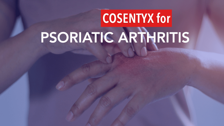 Cosentyx Improves Mobility and Quality of Life for Individuals with Psoriasis 