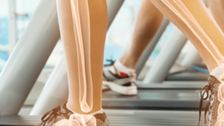 Rheumatoid Arthritis and Exercise