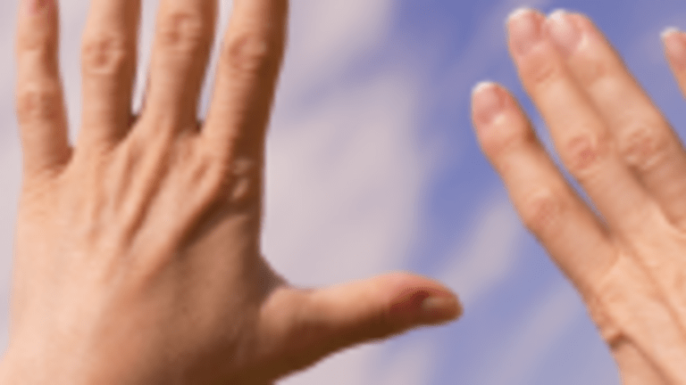 Cimzia® plus Methotrexate Slows Disease Progression in Rheumatoid Arthritis