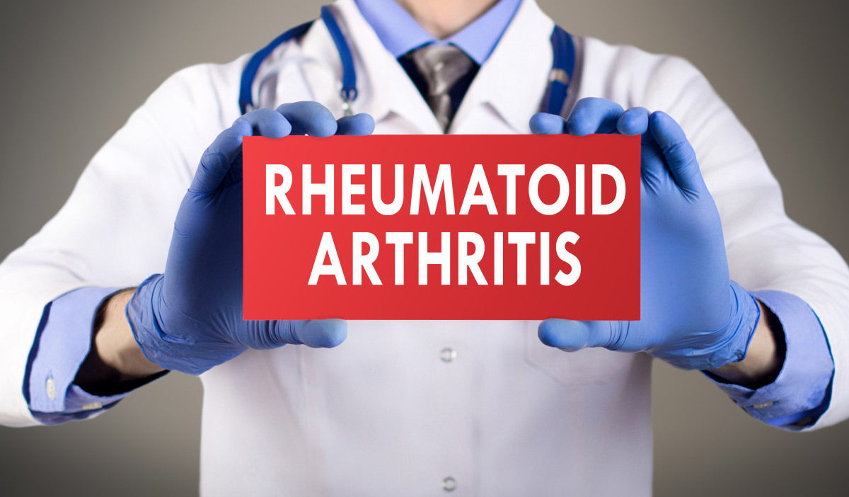 Rheumatoid Arthritis Newly Diagnosed Start Here The Arthritis
